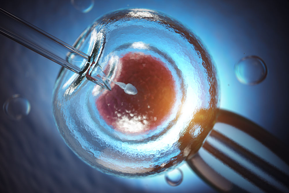 Diferencia entre FIV e Inseminación Artificial. Dra Ivonne Aragón.